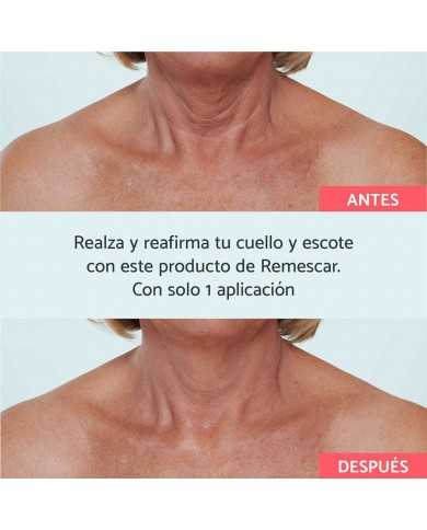 REMESCAR CUELLO Y ESCOTE 40 ML REMESCAR CUELLO Y ESCOTE 40 ML