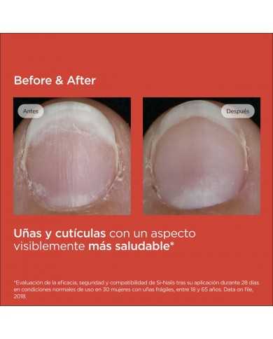 ISDIN SI-NAILS FORTALECEDOR DE UÑAS 2.5ML